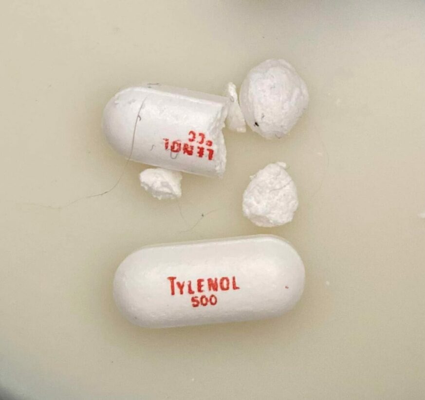 Can Dogs Safely Take Tylenol?